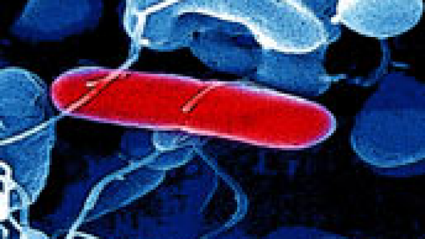 Article image for Food poisoning on the rise