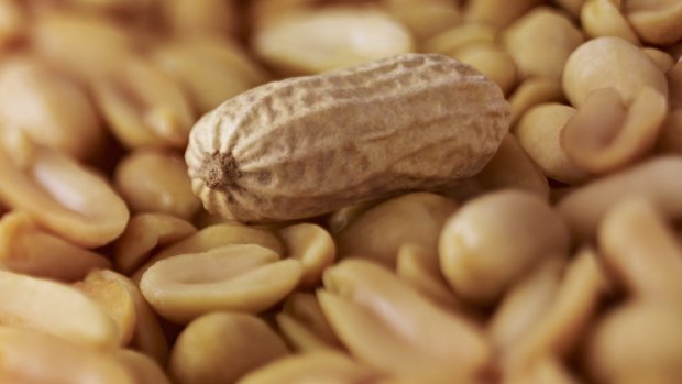 Article image for Who is more likely to have a peanut allergy?