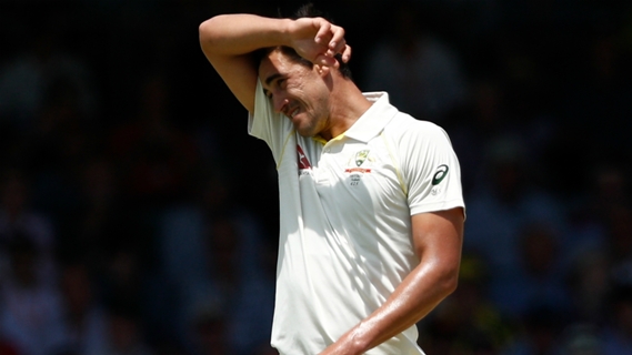 Article image for Starc set to bowl despite bruised heel