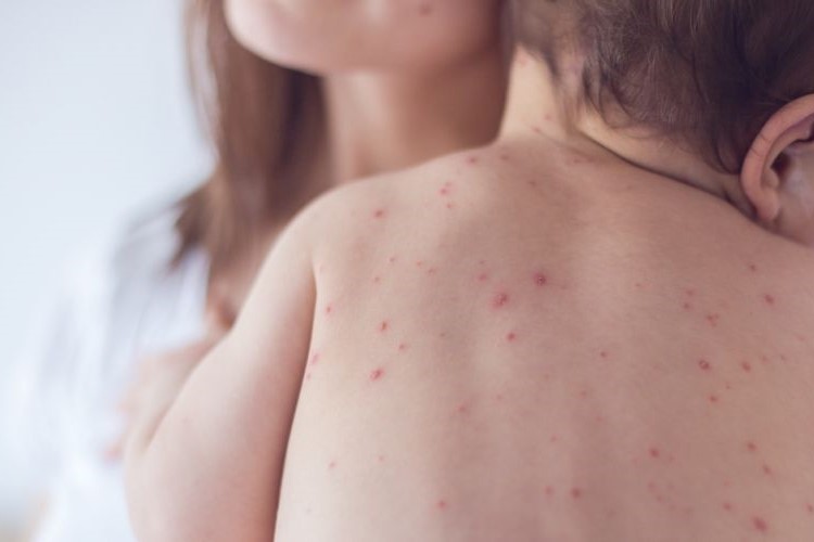 Why has this deadly disease returned?