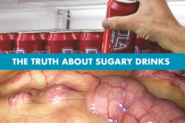 Sugary drinks now just a normal part of every day life… but they’re killing us