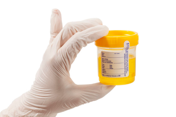 Drug testing – a player’s perspective