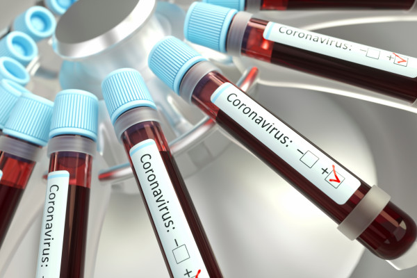 Coronavirus modelling explained