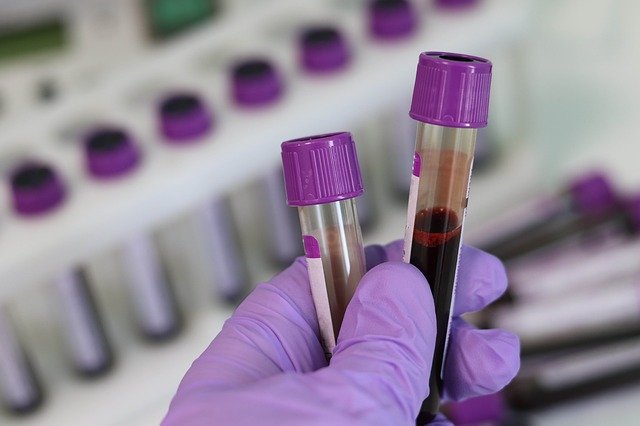 Could this be a game changer for blood cancer patients?
