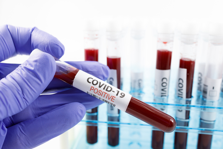 Article image for Fast-spreading UK strain of COVID-19 detected in WA