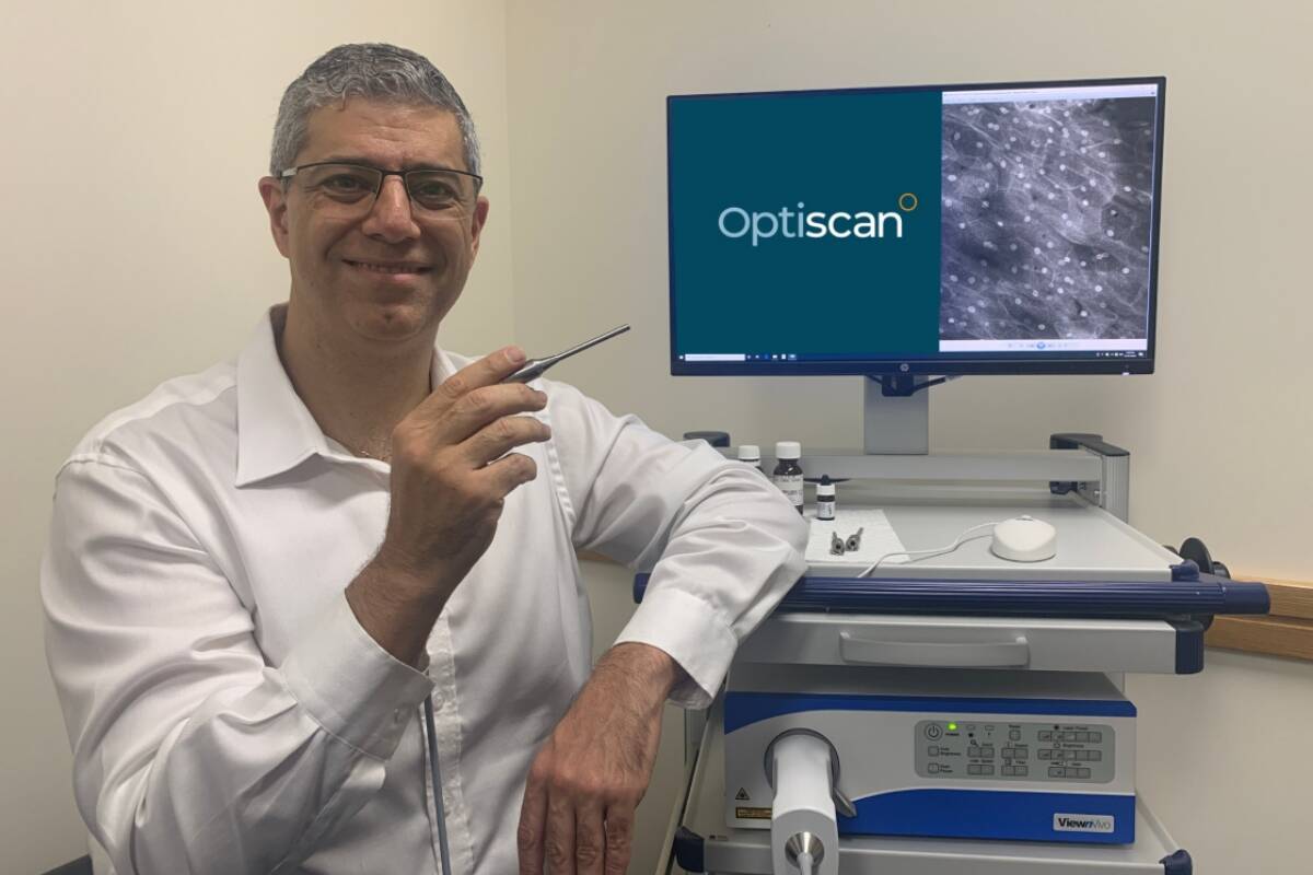 Article image for Optiscan Imaging: No more biopsies!