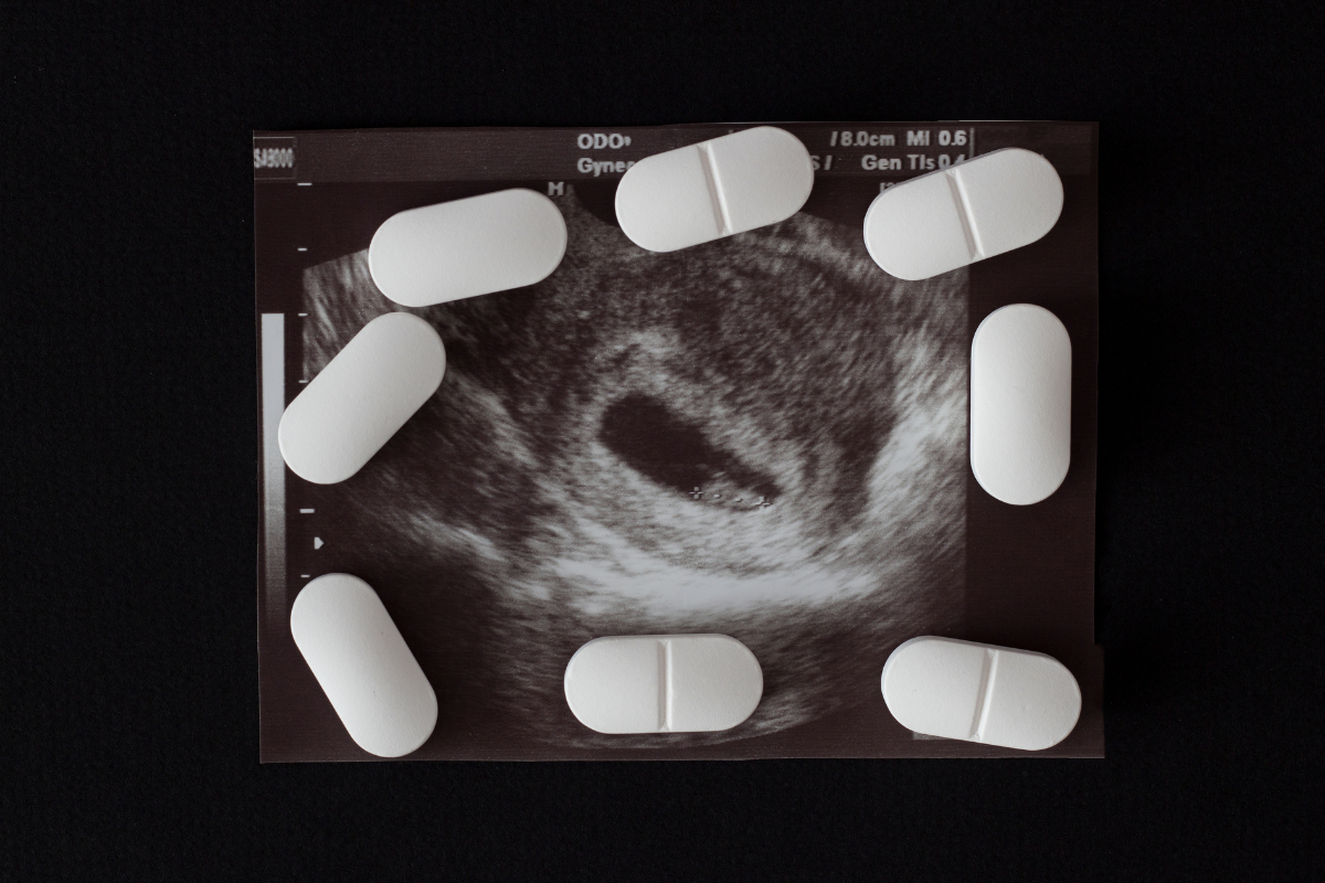 Article image for Abortion at home: regulation changes for termination pill access