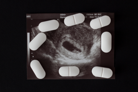 Abortion at home: regulation changes for termination pill access