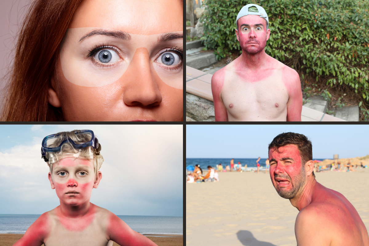 Article image for As the skin cancer season approaches, are we doing enough to prevent it?