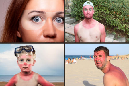 As the skin cancer season approaches, are we doing enough to prevent it?