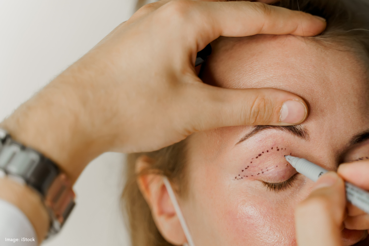Article image for Eyelid surgery has emerged as the world’s most popular plastic surgery procedure