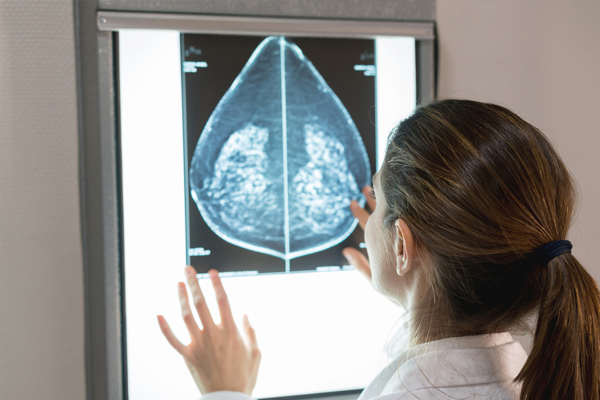 Article image for How breastfeeding reduces breast cancer risk