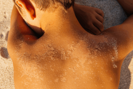 Why the “Slip, Slop, Slap” message is missing today’s Australian teens