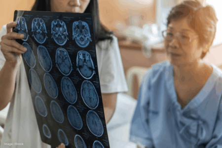 New Alzheimer’s blood test approved for early detection